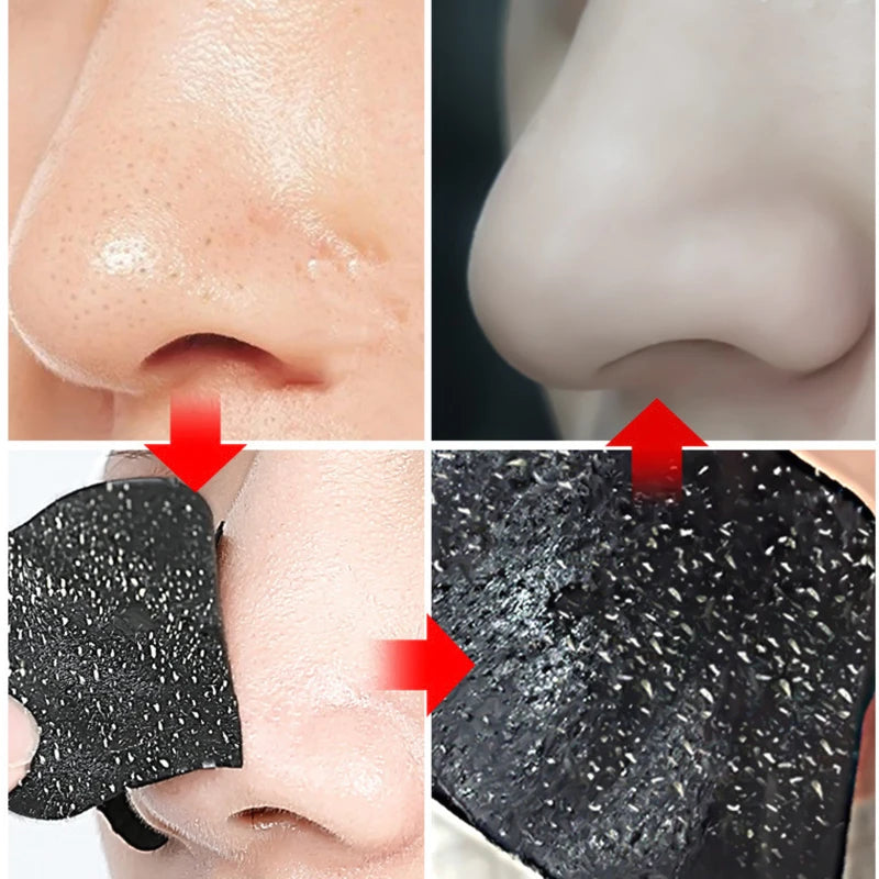 10/20/50pcs Nose Strips For Blackheads Acne Removal Instant Pore Unclogging Strips